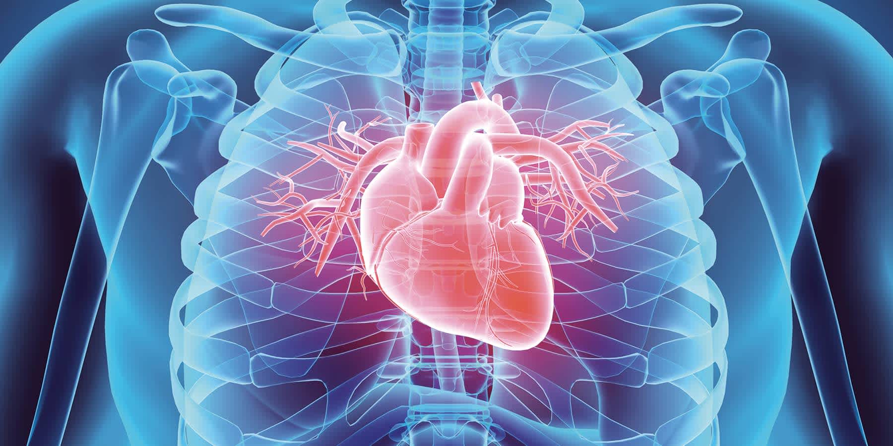 Heart Disease - image 1