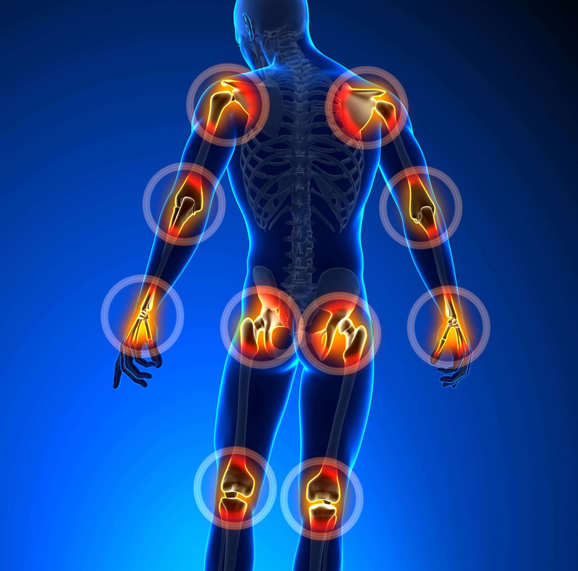 Joint Pain - image 1