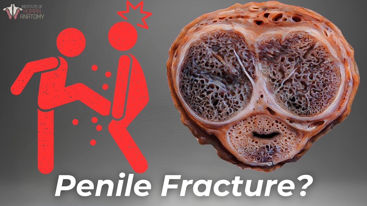 Is Penis Fracture Possible? - image 5