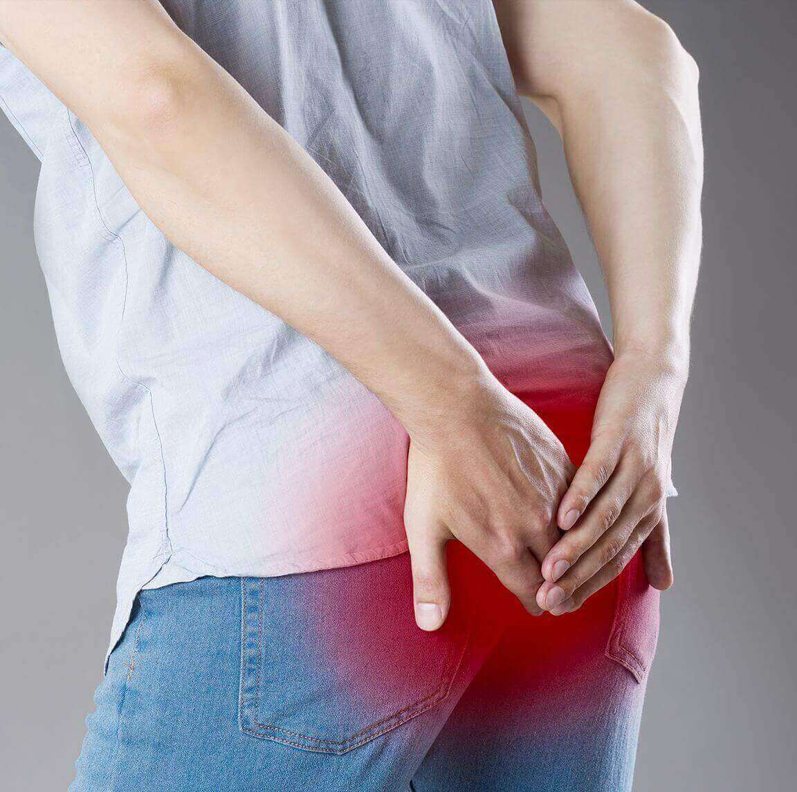 Piles (Hemorrhoids) - image 2