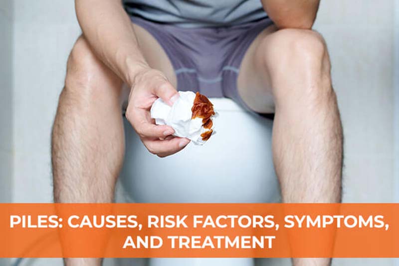 Piles (Hemorrhoids)