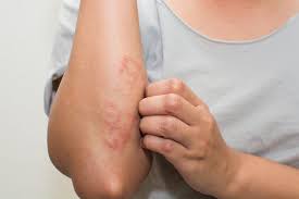 Skin Diseases - image 1
