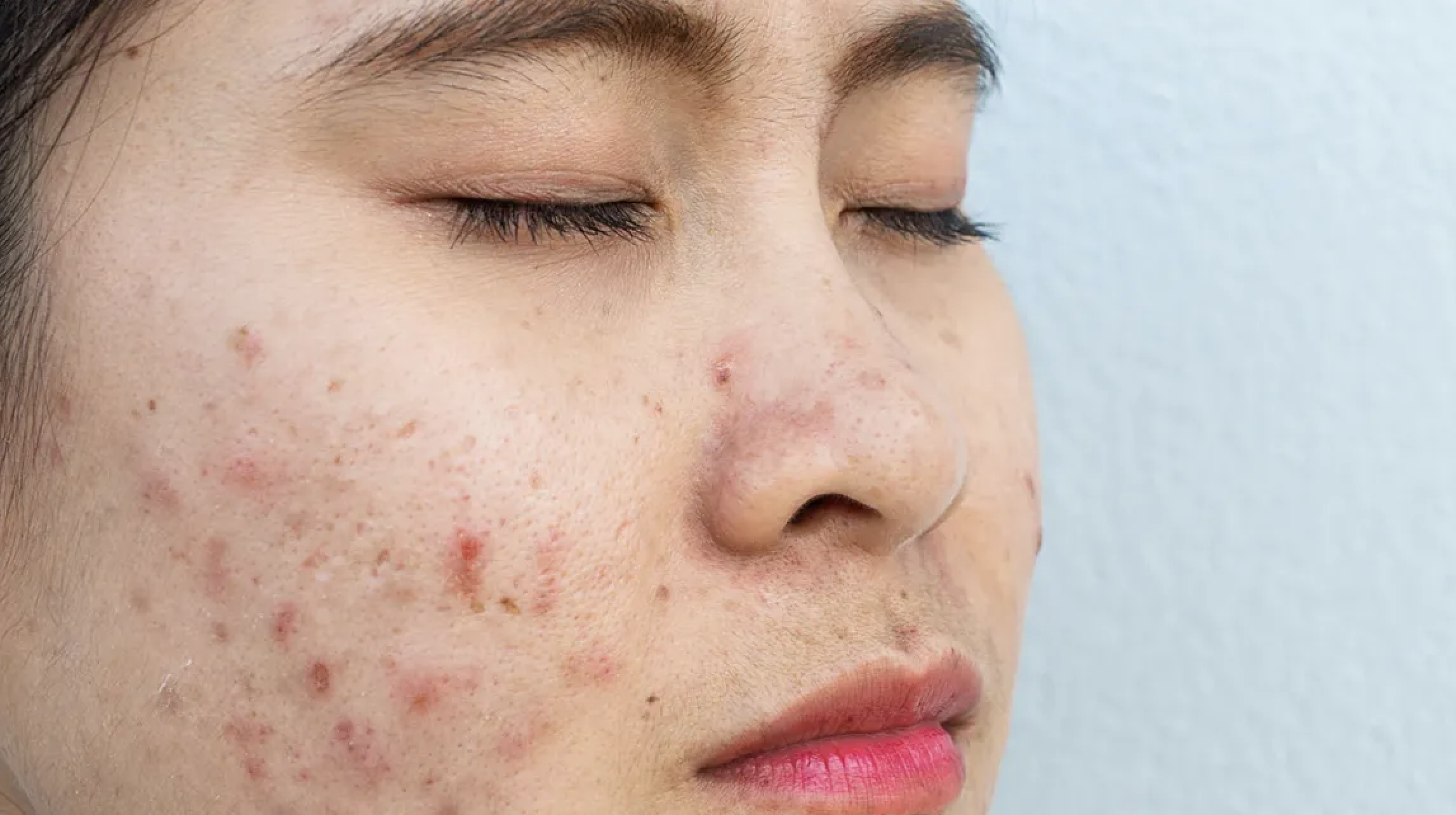 Skin Diseases - image 2